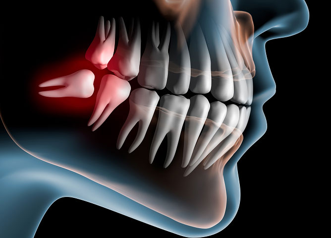 dentist near Denver, CO