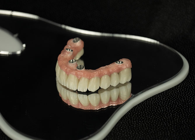 All on X implants near Denver, CO