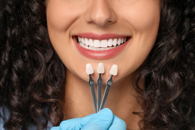 Smiling woman holding porcelain veneer shade samples labeled A1, A2, and A3, showcasing options for cosmetic dental enhancement.