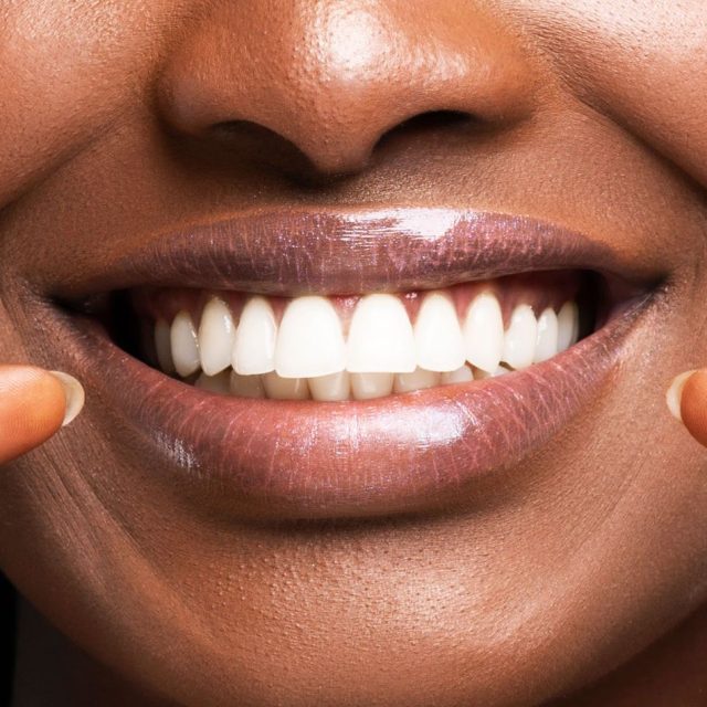 Smiling person showcasing straight, white teeth while holding clear aligners, symbolizing effective orthodontic treatment options at Littleton Advanced Dentistry.