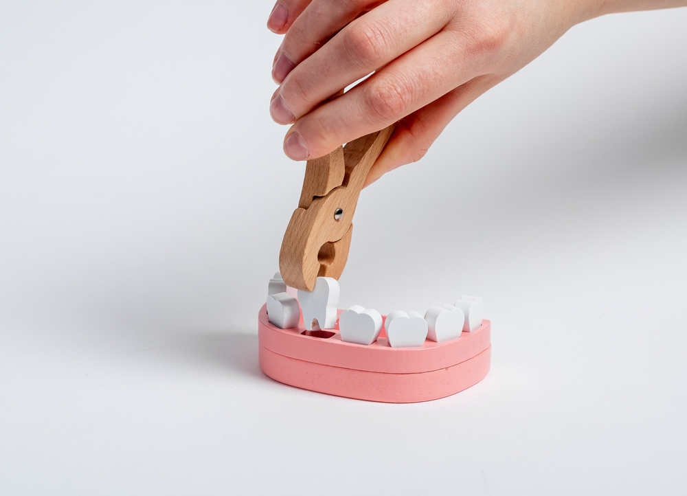 Tooth Extractions